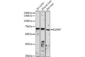 Western blot analysis of extracts of various cell lines, using IL1RAP antibody (ABIN6128127, ABIN6142347, ABIN6142348 and ABIN6220984) at 1:1000 dilution. (IL1RAP antibody  (AA 21-356))