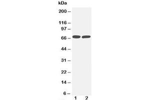 Western blot testing of TNFR2 antibody and Lane 1:  MM453;  2: Jurkat cell lysate.