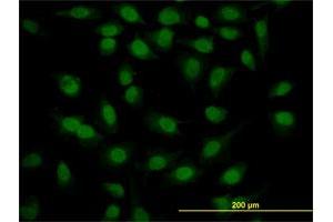 Immunofluorescence of monoclonal antibody to SURB7 on HeLa cell. (MED21 antibody  (AA 1-144))