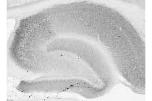 Adult rat brain hippocampus immunohistochemistry.