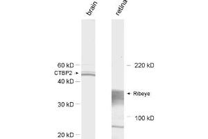 dilution: 1 : 1000, sample: left: rat brain homogenate; right: retina extract (Ribeye (AA 974-988) antibody)