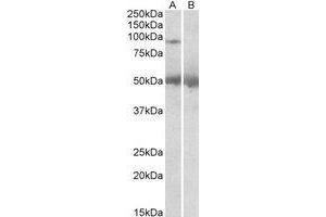 Western Blotting (WB) image for anti-Ubiquitin Specific Peptidase 6 (USP6) (C-Term) antibody (ABIN2466427) (USP6 antibody  (C-Term))