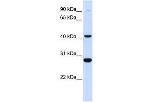 CYB561 antibody used at 1 ug/ml to detect target protein. (CYB561 antibody  (Middle Region))