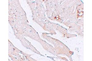 IHC in mouse brain tissue with antibody at 2. (Klotho antibody  (Center))
