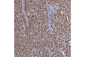 IHC analysis of TRMT61A using anti-TRMT61A antibody (ABIN7599220). (TRMT61A antibody  (AA 1-289))