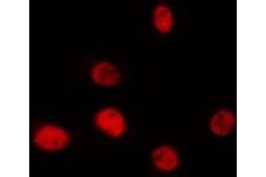 ABIN6275392 staining Hela by IF/ICC. (PRPF39 antibody  (C-Term))