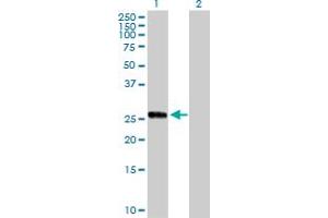 Western Blot analysis of CCRK expression in transfected 293T cell line by CCRK MaxPab polyclonal antibody.