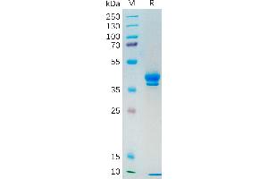 Human Protein, hFc Tag on SDS-PAGE under reducing condition.