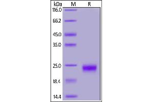 Cynomolgus IL-17F, His Tag on  under reducing (R) condition. (IL17F Protein (AA 31-163) (His tag))