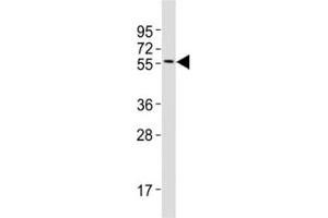 Western blot testing of MITF antibody at 1:2000 dilution + A375 lysate