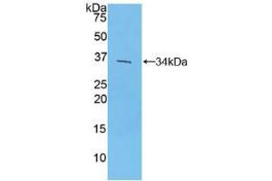 Western blot analysis of recombinant Mouse IRF4.