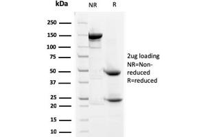 SDS-PAGE Analysis Purified Prohibitin Mouse Monoclonal Antibody (SPM311). (Prohibitin antibody  (AA 167-261))