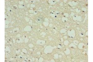 Immunohistochemistry of paraffin-embedded human brain tissue using ABIN7149470 at dilution of 1:100 (DRD5 antibody  (AA 361-477))