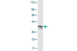 Western Blot detection against Immunogen (37. (PDE5A antibody  (AA 29-138))