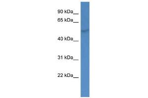 WB Suggested Anti-GMEB1 Antibody Titration:  0. (GMEB1 antibody  (N-Term))