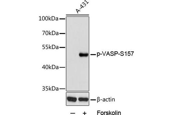 VASP antibody  (pSer157)