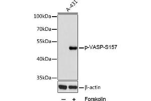 Western blot analysis of extracts of  cells, using Phospho-VASP-S157 antibody (ABIN6135335, ABIN6136286, ABIN6136287 and ABIN6225657) at 1:2000 dilution.