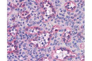 Immunohistochemistry (IHC) image for anti-Sterol Regulatory Element Binding Transcription Factor 2 (SREBF2) (AA 304-353) antibody (ABIN6745766)