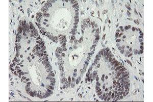 Image no. 2 for anti-Transducin-Like Enhancer of Split 1 (E(sp1) Homolog, Drosophila) (TLE1) (AA 180-460) antibody (ABIN1491050) (TLE1 antibody  (AA 180-460))