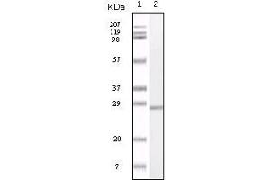 Western blot analysis using S100A mouse mAb against truncated S100A recombinant protein. (S100A1 antibody)