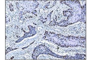 IHC analysis of Ki67 using anti-Ki67 antibody (ABIN7601100).