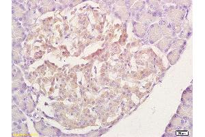 Formalin-fixed and paraffin embedded rat pancreas labeled with Anti-Rad51 Polyclonal Antibody, unconjugated (ABIN673584) at 1:200 followed by incubation with conjugated secondary antibody and DAB staining. (RAD51 antibody  (AA 241-339))