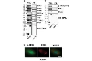 Western Blot and Immunofluorescence of Anti-EDC3 phosho S161 status in P-bodies. (EDC3 antibody  (pSer161))
