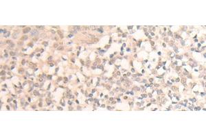 Immunohistochemistry of paraffin-embedded Human tonsil tissue using MLLT6 Polyclonal Antibody at dilution of 1:40(x200) (MLLT6 antibody)
