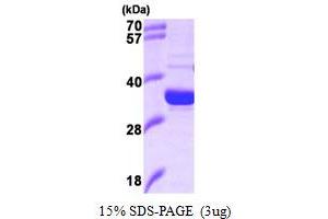 SDS-PAGE (SDS) image for Heme Oxygenase (Decycling) 2 (HMOX2) (AA 1-264) protein (ABIN666941) (HMOX2 Protein (AA 1-264))