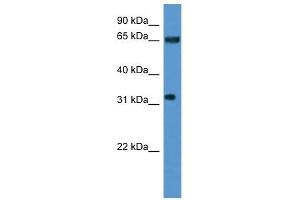 Western Blot showing SRRM4 antibody used at a concentration of 1-2 ug/ml to detect its target protein. (SRRM4 antibody  (Middle Region))
