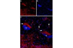 Expression of Muscarinic acetylcholine receptor M4 in mouse islands of Calleja - Immunohistochemical staining of mouse islands of Calleja (ventral striatum) using Anti-CHRM4 Antibody (ABIN7043064, ABIN7044584 and ABIN7044585). (CHRM4 antibody  (AA 330-340))