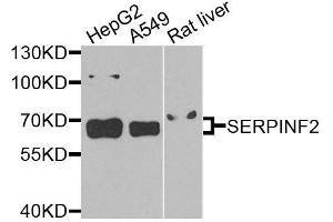 Western blot analysis of extracts of various cell lines, using SERPINF2 antibody (ABIN6003653) at 1/1000 dilution. (alpha 2 Antiplasmin antibody)