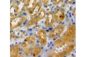 Used in DAB staining on fromalin fixed paraffin-embedded Kidney tissue (LAMC2 antibody  (AA 28-196))