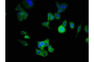 Immunofluorescence staining of HepG2 cells with ABIN7145104 at 1:333, counter-stained with DAPI. (ATG16L1 antibody  (AA 1-607))
