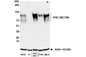 Western Blotting (WB) image for anti-Nectin-1 (NECTIN1) (AA 225-275) antibody (ABIN7795685) (Recombinant Nectin-1 (NECTIN1) (AA 225-275) antibody)