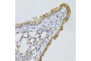 Immunohistochemistry of paraffin-embedded mouse lung using GPD2 Antibody.