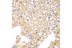 Immunohistochemistry of paraffin-embedded mouse liver using PPP2R2A antibody.