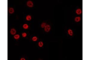 ABIN6274822 staining A549 by IF/ICC. (AARSD1 antibody  (Internal Region))