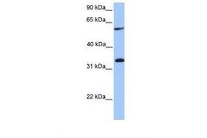 Image no. 1 for anti-Testis-Specific serine Kinase Substrate (TSKS) (AA 351-400) antibody (ABIN6738899) (TSKS antibody  (AA 351-400))