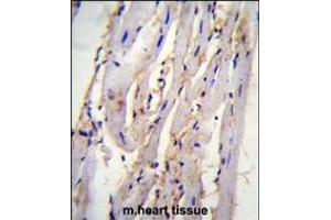 STX19 Antibody immunohistochemistry analysis in formalin fixed and paraffin embedded m. (Syntaxin 19 antibody  (C-Term))