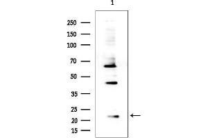 anti-Ribosomal Protein S15 (RPS15) (C-Term) antibody