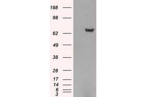 Image no. 2 for anti-Histone Deacetylase 10 (HDAC10) antibody (ABIN1498609) (HDAC10 antibody)