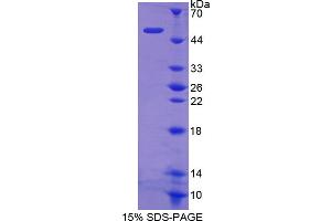 Image no. 1 for Ras Homolog Gene Family, Member Q (RHOQ) (AA 1-202) protein (His tag,GST tag) (ABIN6238262) (RHOQ Protein (AA 1-202) (His tag,GST tag))