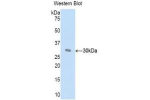 Western blot analysis of recombinant Mouse CFD. (Adipsin antibody  (AA 1-259))