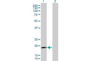 Western Blot analysis of IFNA17 expression in transfected 293T cell line by IFNA17 MaxPab polyclonal antibody. (IFNA17 antibody  (AA 1-189))