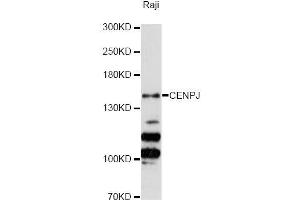 Western blot analysis of extracts of Raji cells, using CENPJ Antibody (ABIN5996394) at 1:3000 dilution. (CENPJ antibody)
