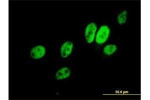 Immunofluorescence of purified MaxPab antibody to ERCC8 on HeLa cell.