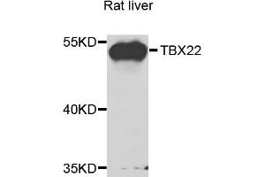 Western blot analysis of extracts of rat liver, using TBX22 antibody (ABIN5975188) at 1/1000 dilution. (T-Box 22 antibody)