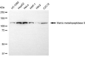 Western blotting analysis using matrix metallopeptidase 9 antibody (ABIN7799342).