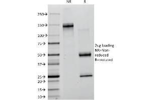 SDS-PAGE Analysis Purified Creatine Kinase-B (CKB) Mouse Monoclonal Antibody (CKB/1268). (CKB antibody)
